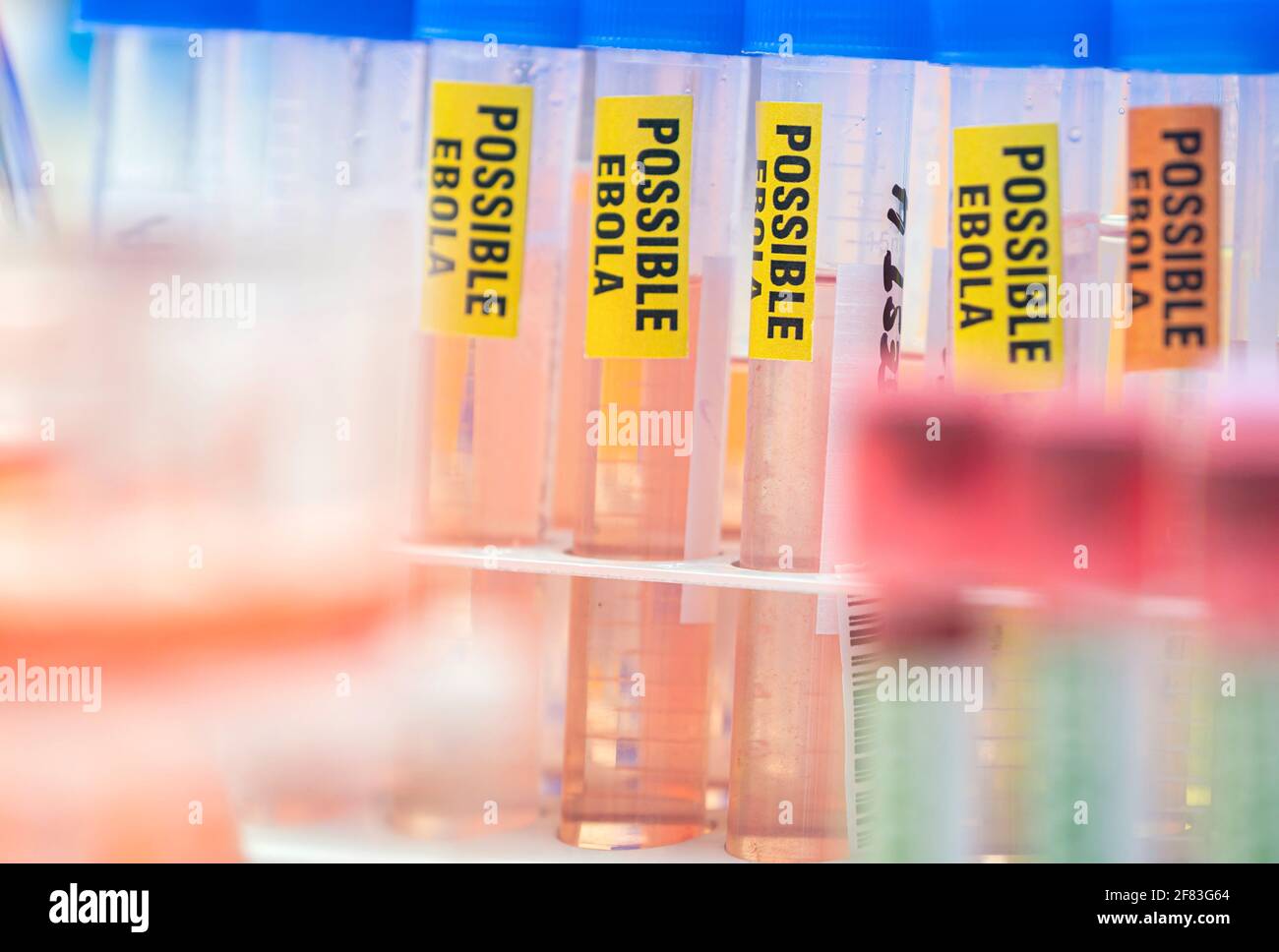 Probenfläschchen mit Blut von möglichen Ebola-Patienten, die mit dem neuen Zaire-Stamm von Ebola infiziert sind, Konzeptbild Stockfoto