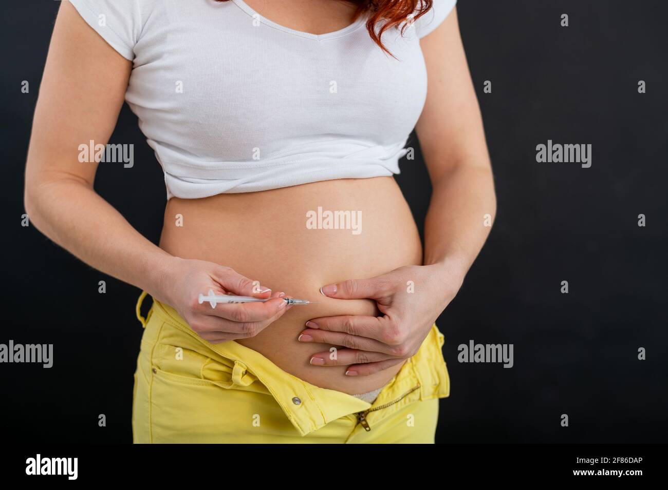 Gesichtslose Frau spritzt Insulin in ihren Magen. Nahaufnahme eines Spritzenstifts. Die subkutane Verabreichung ist ein Heilmittel gegen Diabetes. Stockfoto