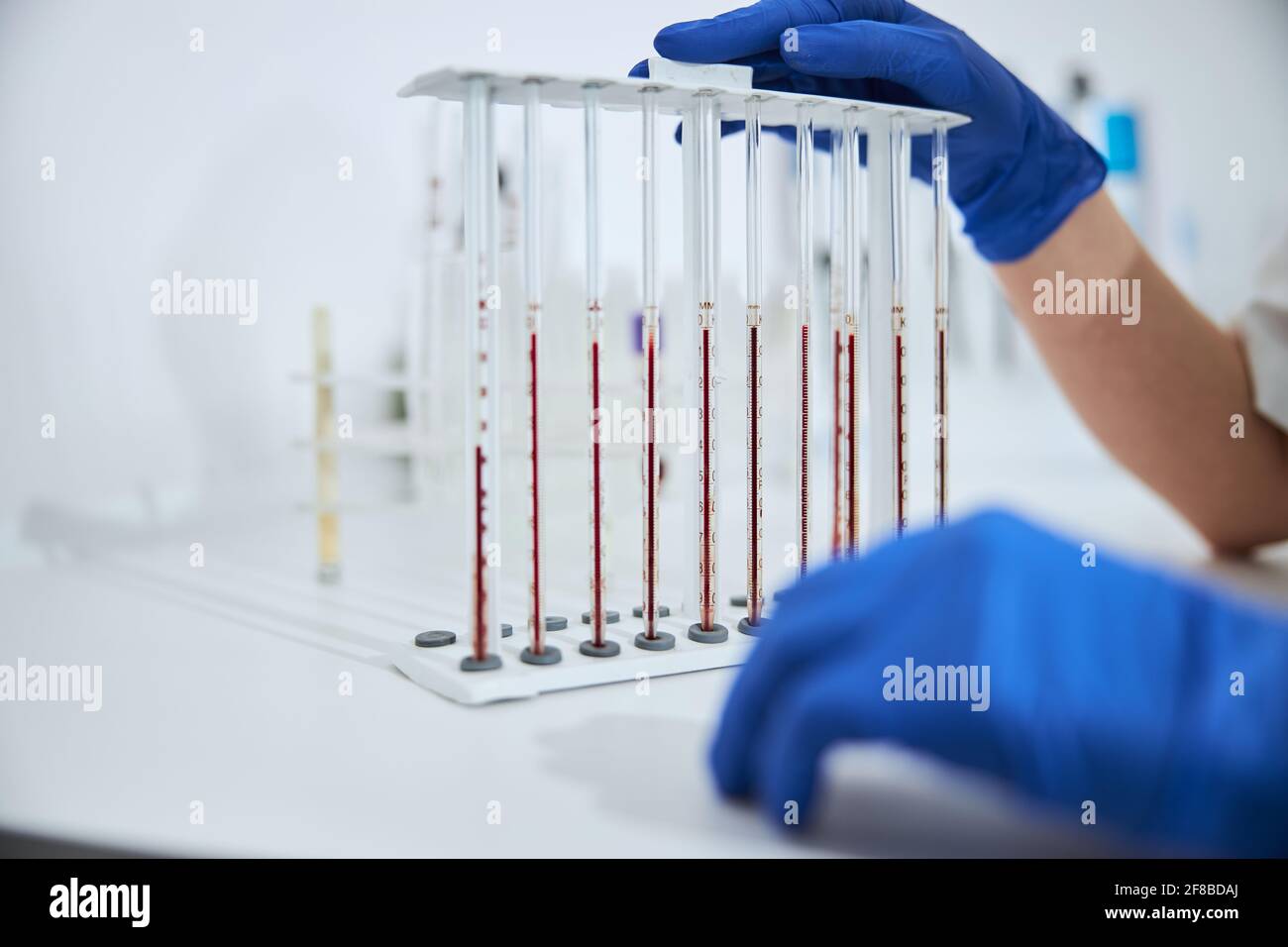 Biochemiker untersucht einen Satz kalibrierter Pipetten Stockfoto