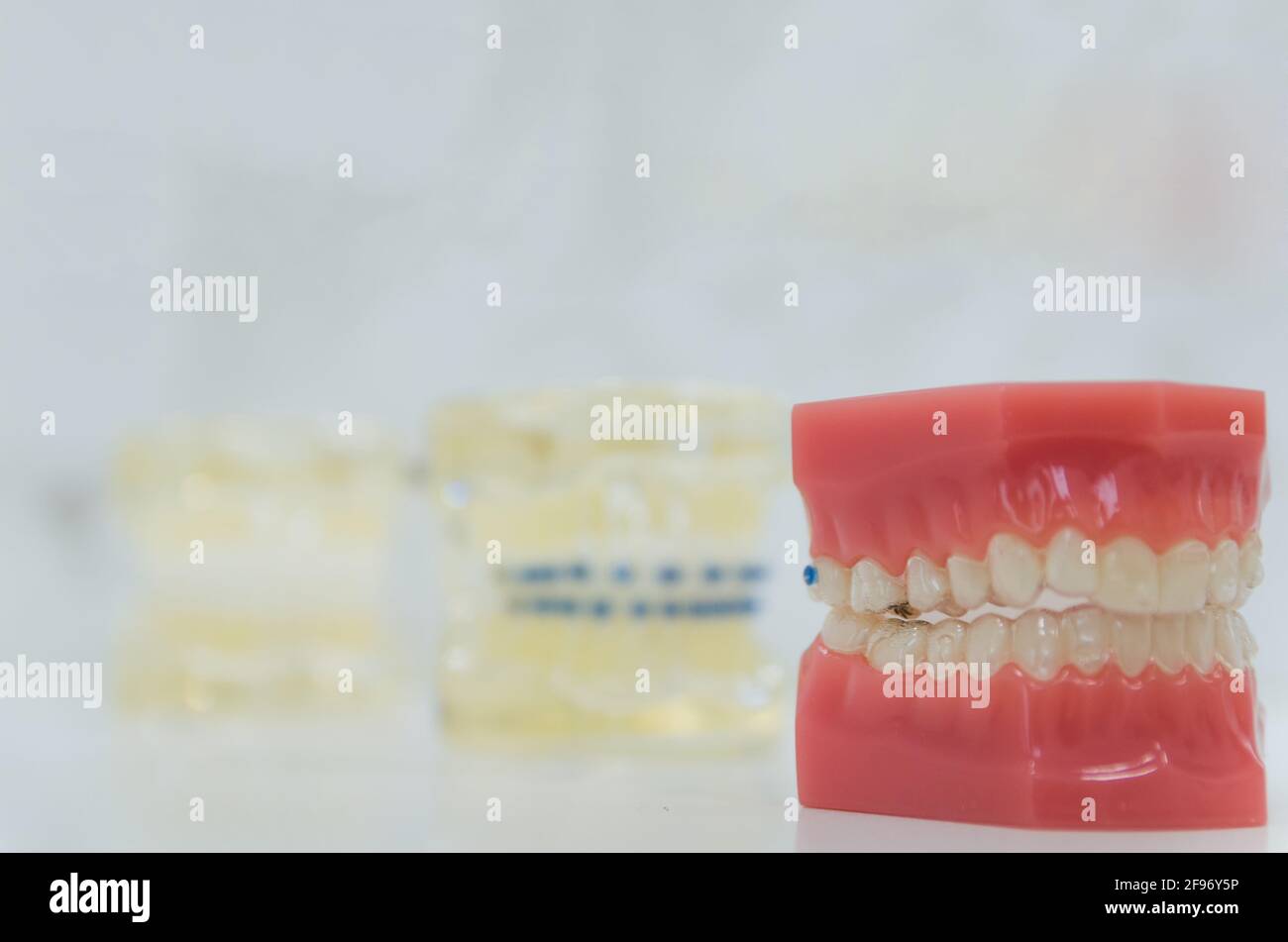 Zahnmedizinisches Modell der unsichtbaren zahnmedizinischen Vorrichtung, um dem Kunden zu zeigen. Stockfoto