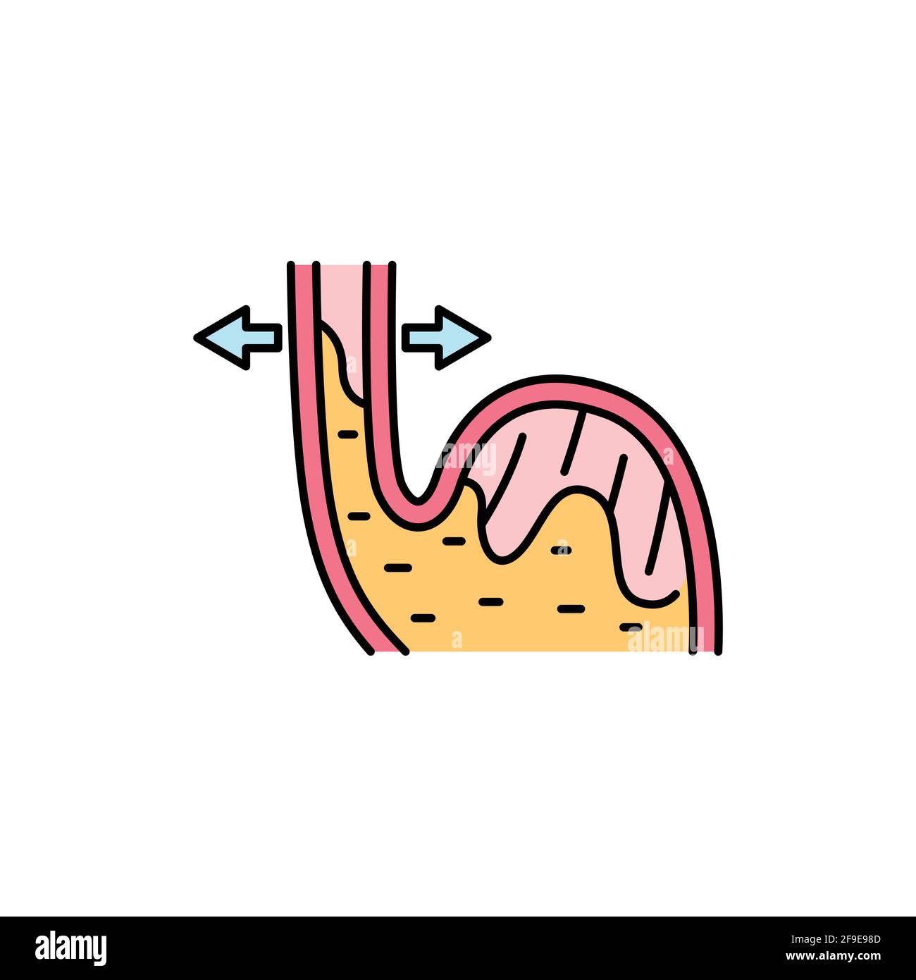 GERD-Symbol für farbige Linie. Gastroösophageale Refluxkrankheit ...