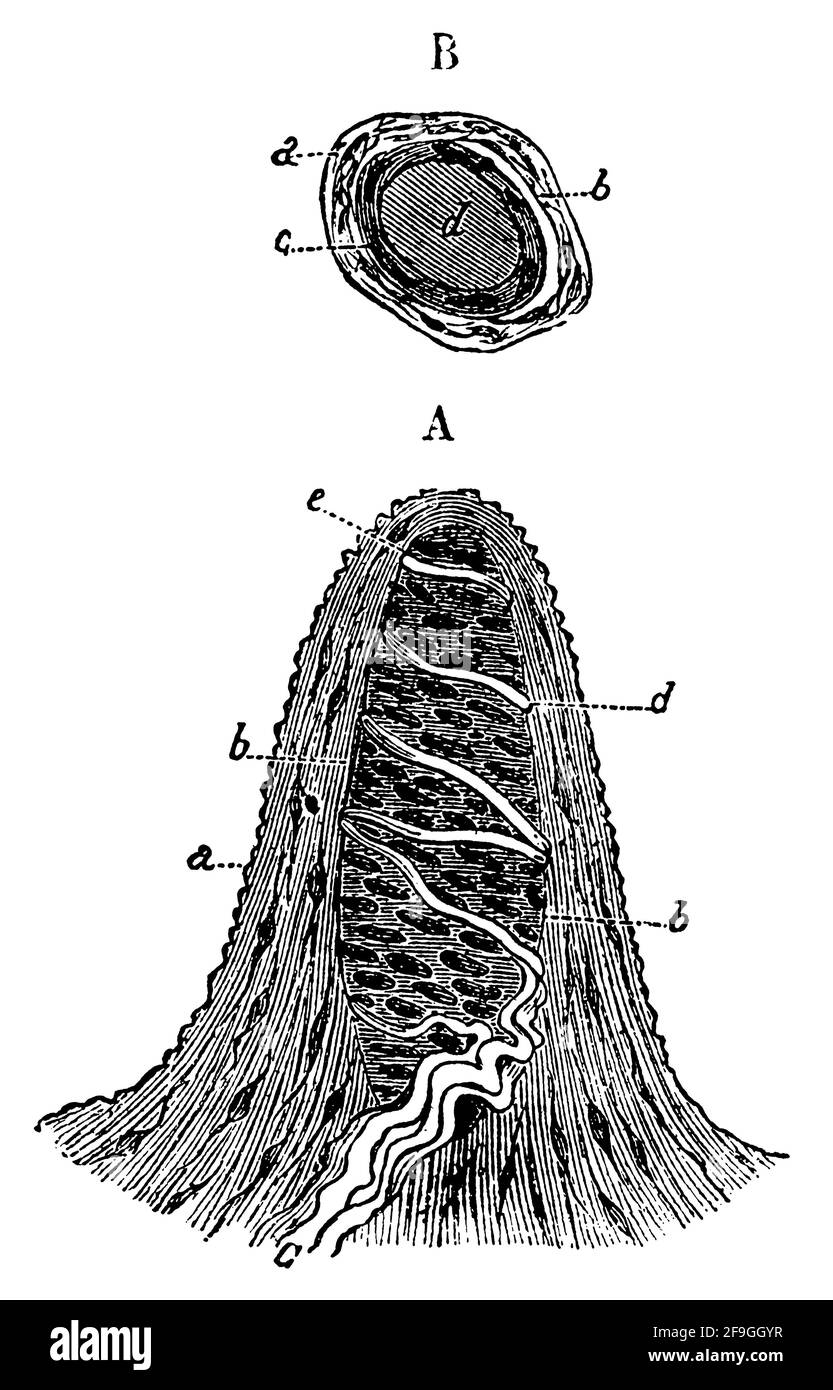 Warze. Illustration des 19. Jahrhunderts. Deutschland. Weißer Hintergrund. Stockfoto