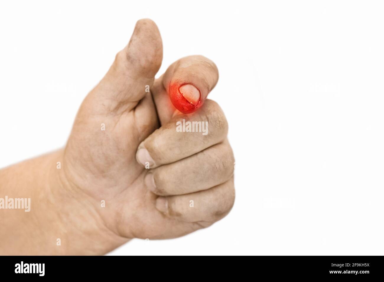 Blutige finger -Fotos und -Bildmaterial in hoher Auflösung – Alamy