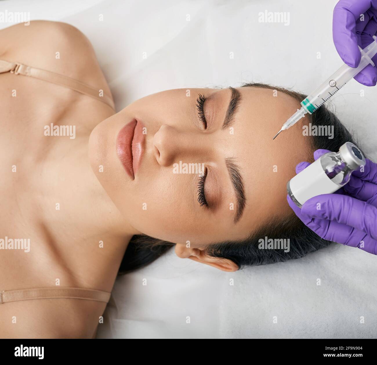 PRX-T33 Peeling. PRX-T33 biorevitalisierungs-Peel für das Gesicht einer Frau in einer Schönheitsklinik. Chirurgiefreie Gesichtsverjüngung Stockfoto