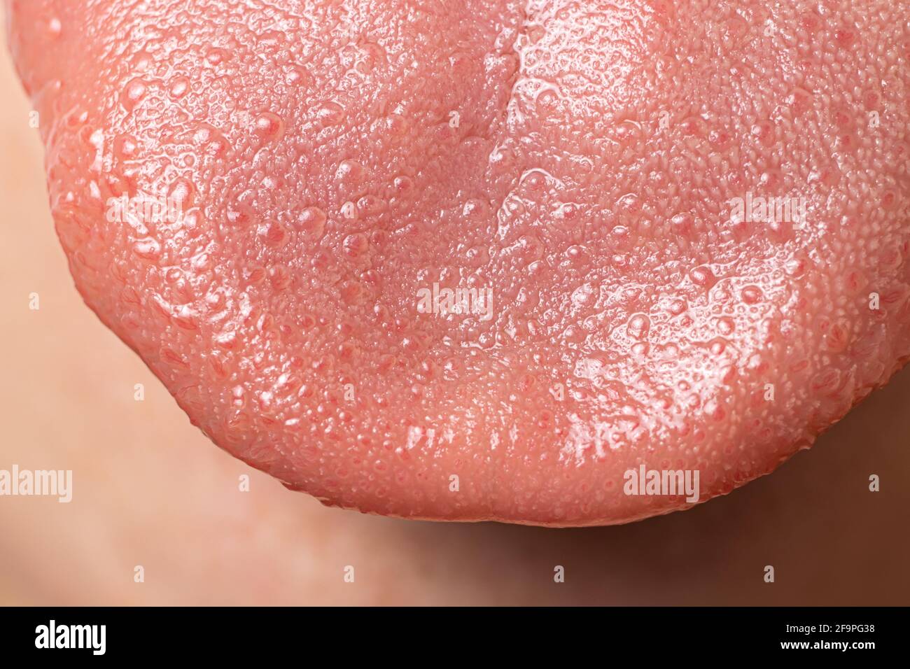 Makro Nahaufnahme Oberfläche der menschlichen Zunge - sensorische Rezeptoren der Papillen, Spitze der Zunge. Stockfoto