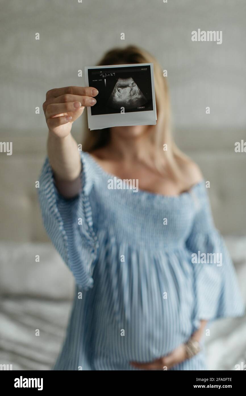 Ein Porträt einer Schwangeren, das ein Ultraschallbild ihres ungeborenen Babys in eine Kamera zeigt. Eine werdende Frau mit einem Sonogramm. Stockfoto