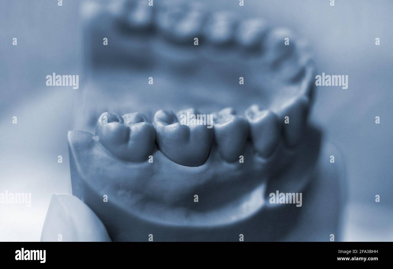 Der Unterkiefer eines Mannes, der auf einem 3d-Drucker aus einem Photopolymermaterial hergestellt wurde Stockfoto