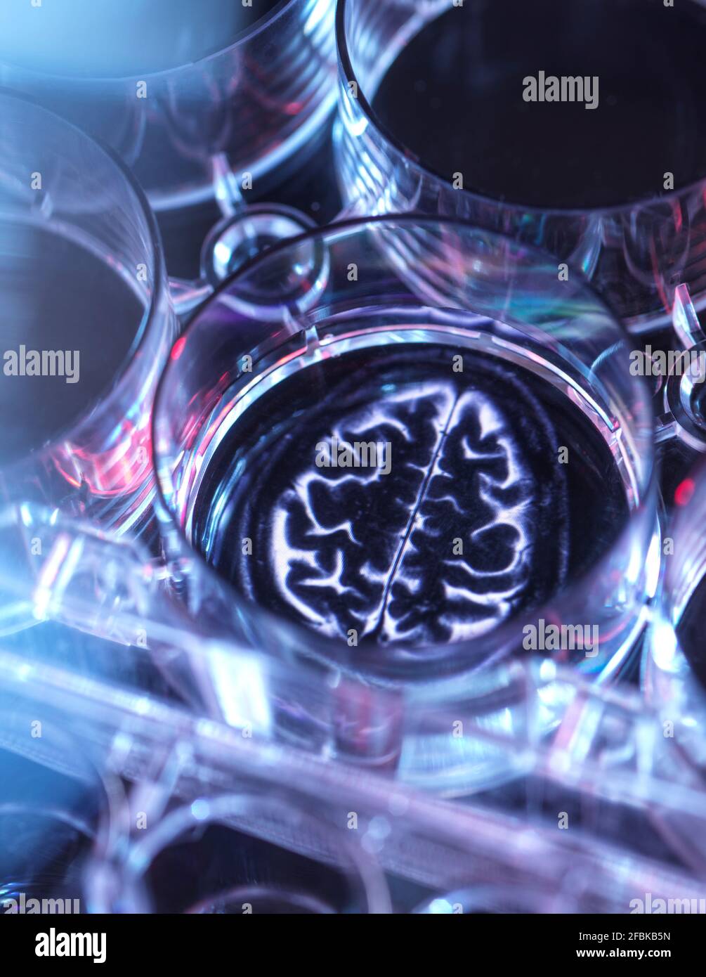 Medizinische Probe in der Mikrotiterplatte mit Bild des menschlichen Gehirns Stockfoto
