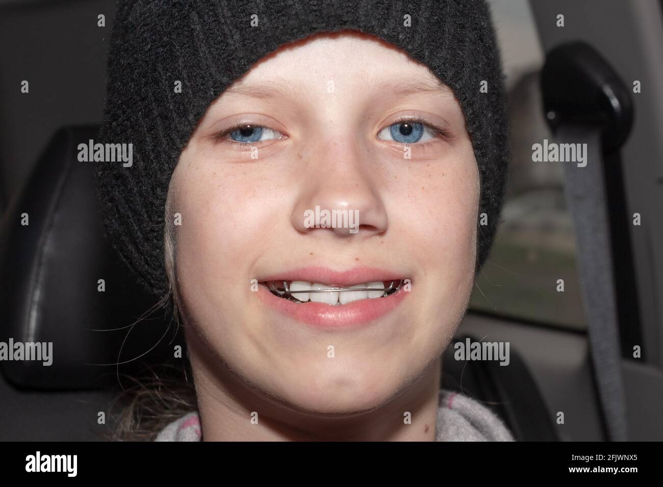 Nahaufnahme eines Teenagers in einem schwarzen Hut mit eisernen Zahnspangen an den Zähnen, lächelnd, in einem Autosalon sitzend. Den Biss und die Schönheit der Zähne glätten. Stockfoto