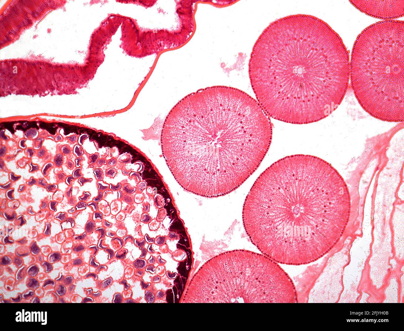 Ascaris querschnitt Fotos und Bildmaterial in hoher Auflösung Alamy