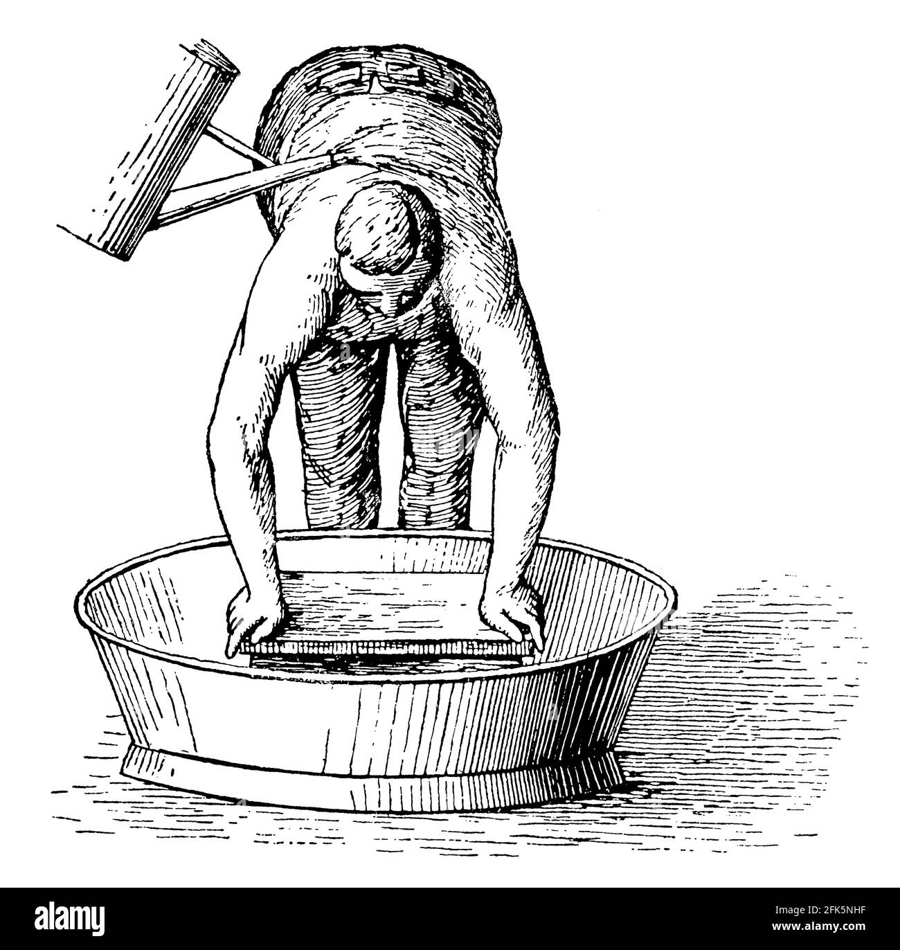 Hydrotherapie des Oberkörpers (Oberguss). Illustration des 19. Jahrhunderts. Deutschland. Weißer Hintergrund. Stockfoto
