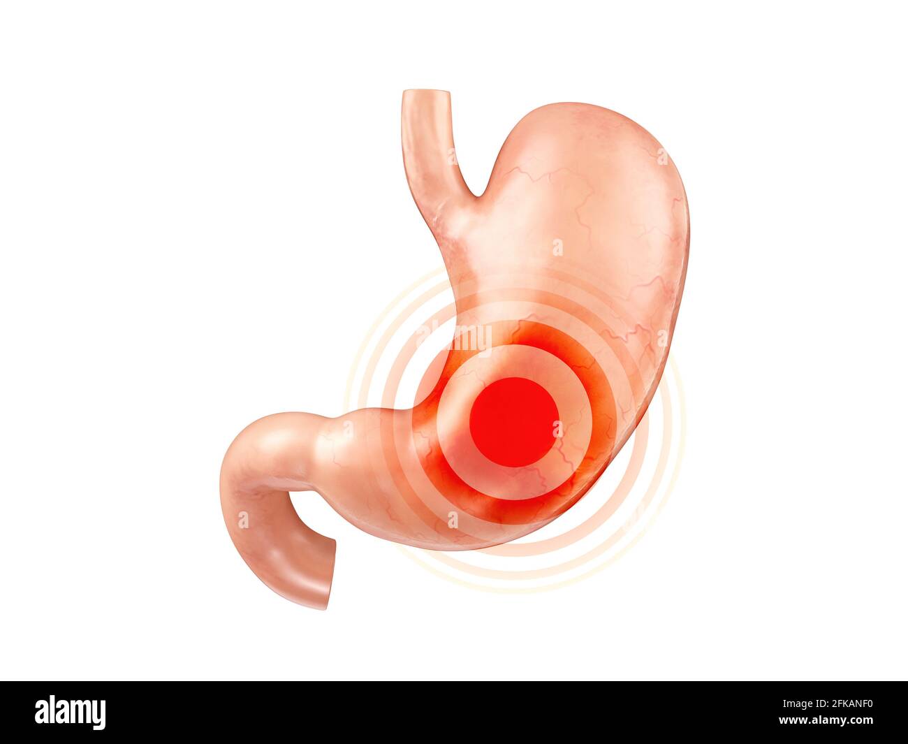 Anatomisch genaue realistische 3d-Darstellung des menschlichen inneren Organs - Magen mit Duodenum isoliert auf weißem Hintergrund Stockfoto