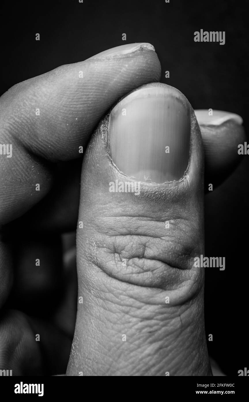Menschliche Haut Schwarzweiss Stockfotos Und Bilder Alamy
