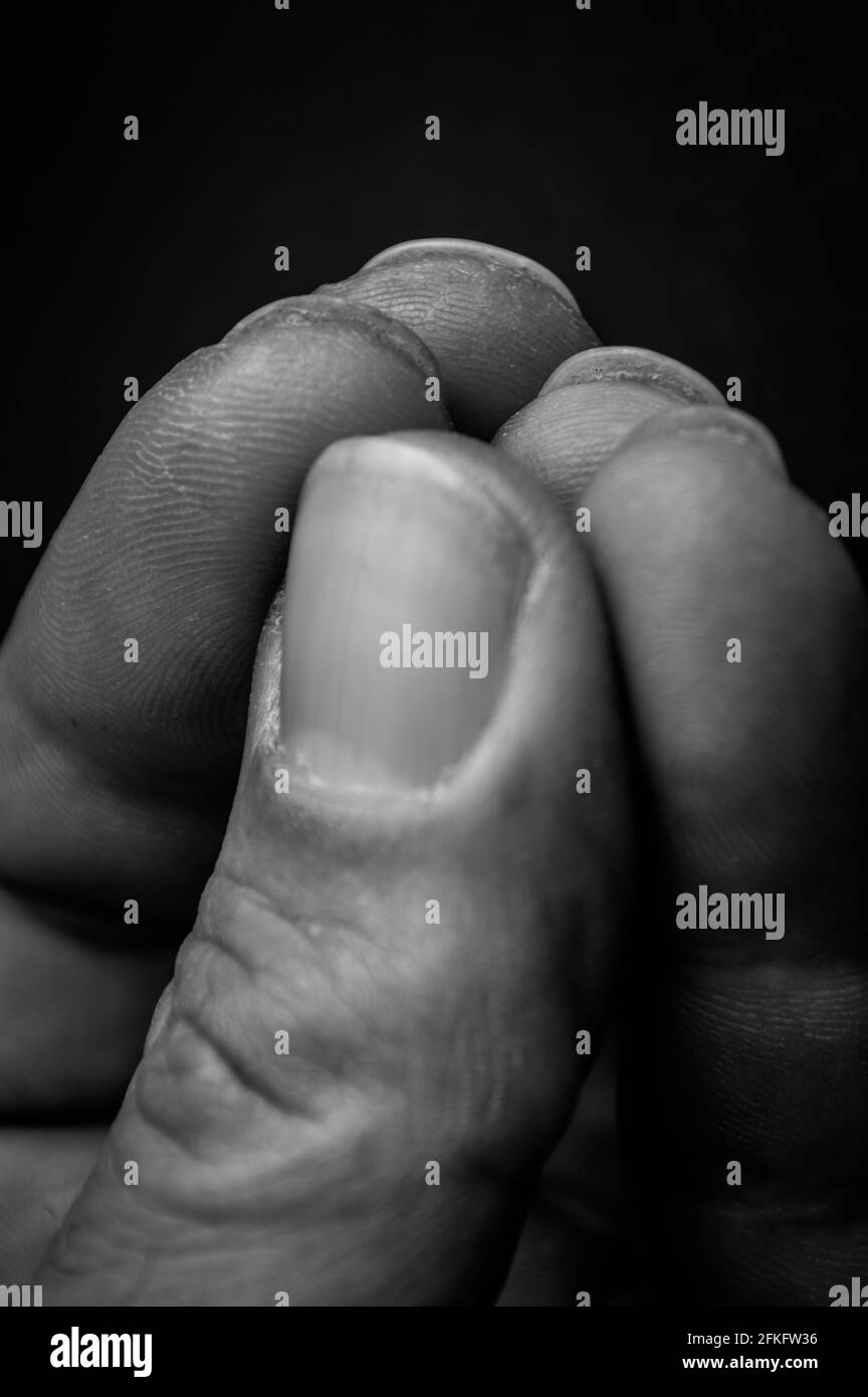Menschliche Haut Schwarzweiss Stockfotos Und Bilder Alamy
