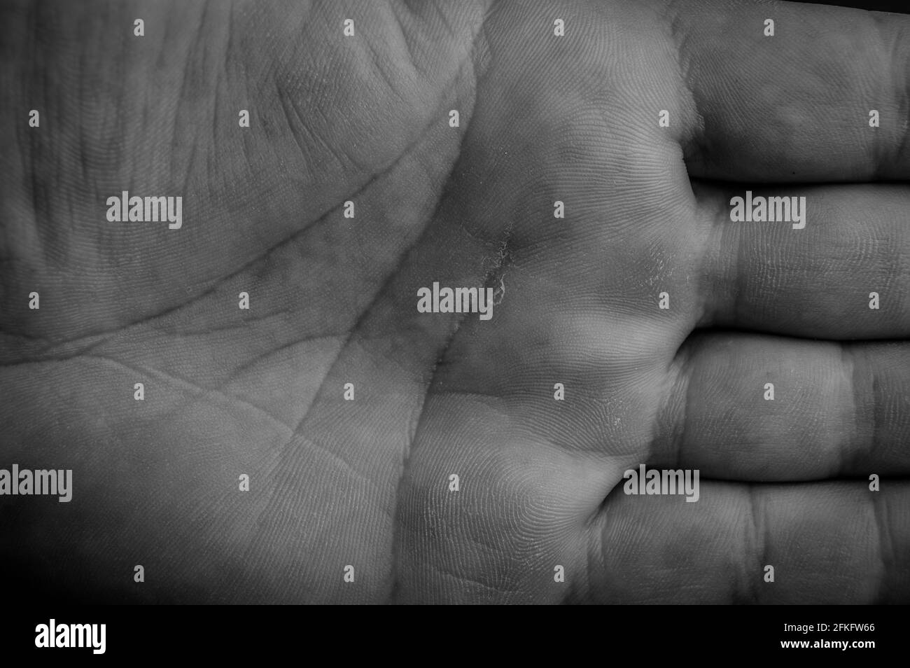 Man Skin Texture Stockfotos Und Bilder Kaufen Alamy
