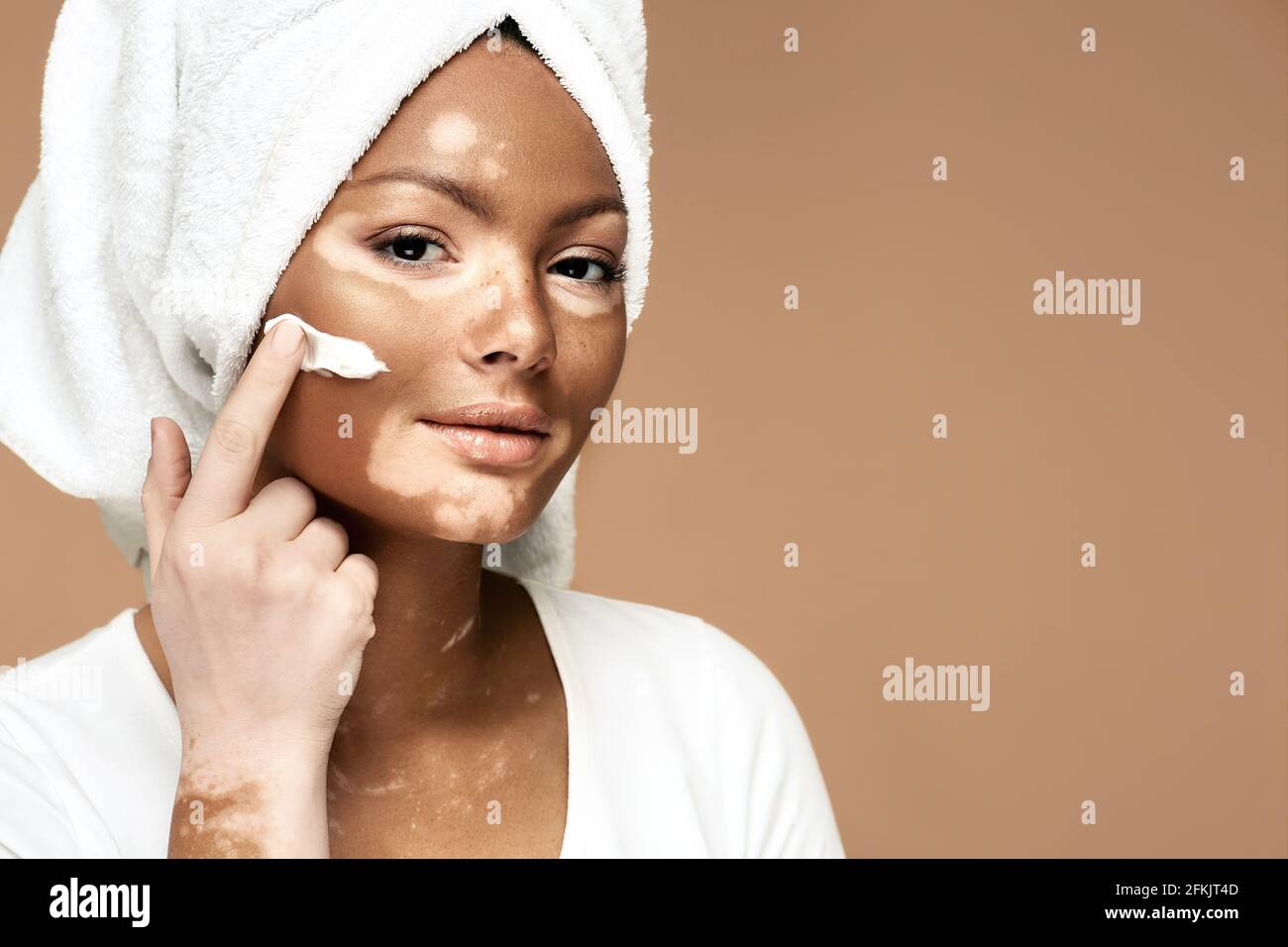 Feuchtigkeitsspendende Haut Konzept. Afroamerikanische Frau mit Vitiligo trägt feuchtigkeitsspendende Creme auf ihr Gesicht, auf einem pastellfarbenen Hintergrund Stockfoto