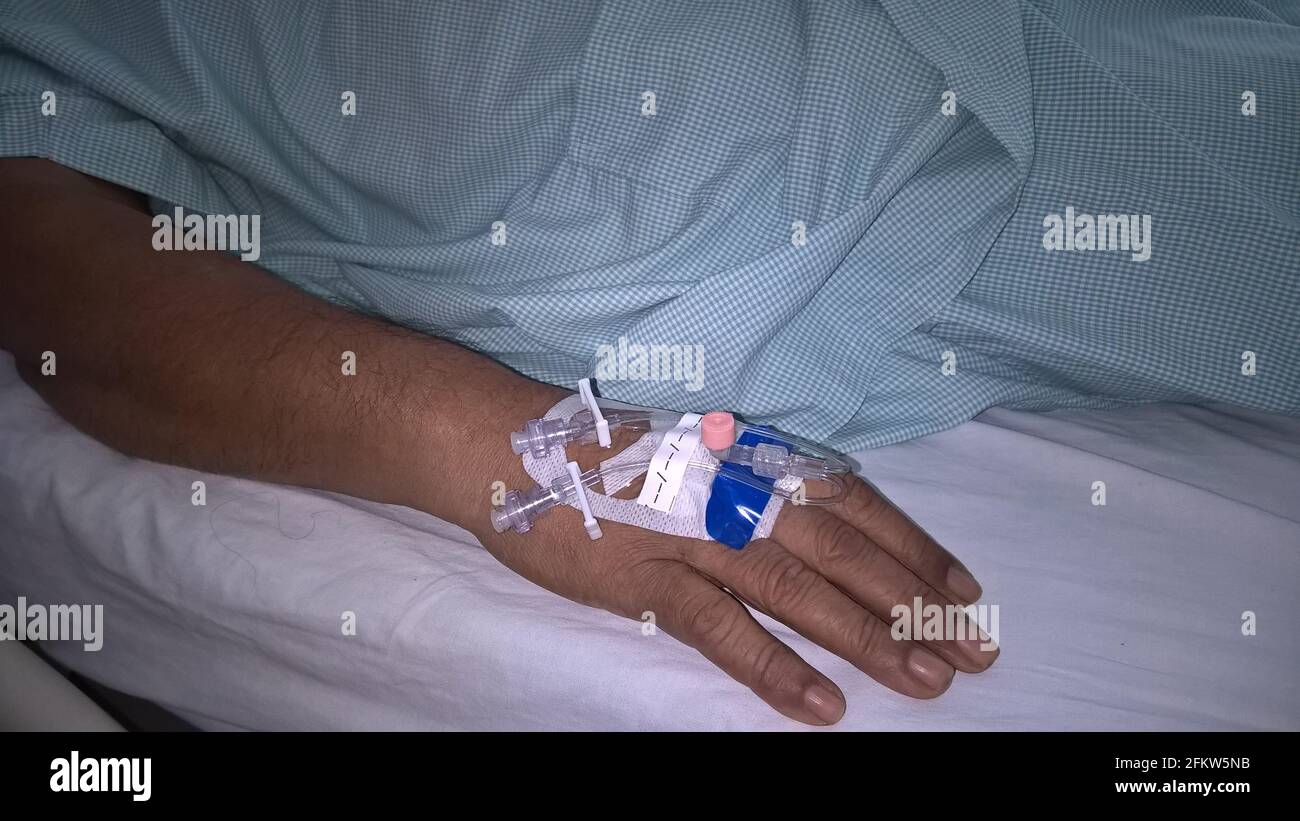 Hand mit peripheren intravenösen Kanülen oder Kathetern Stockfoto