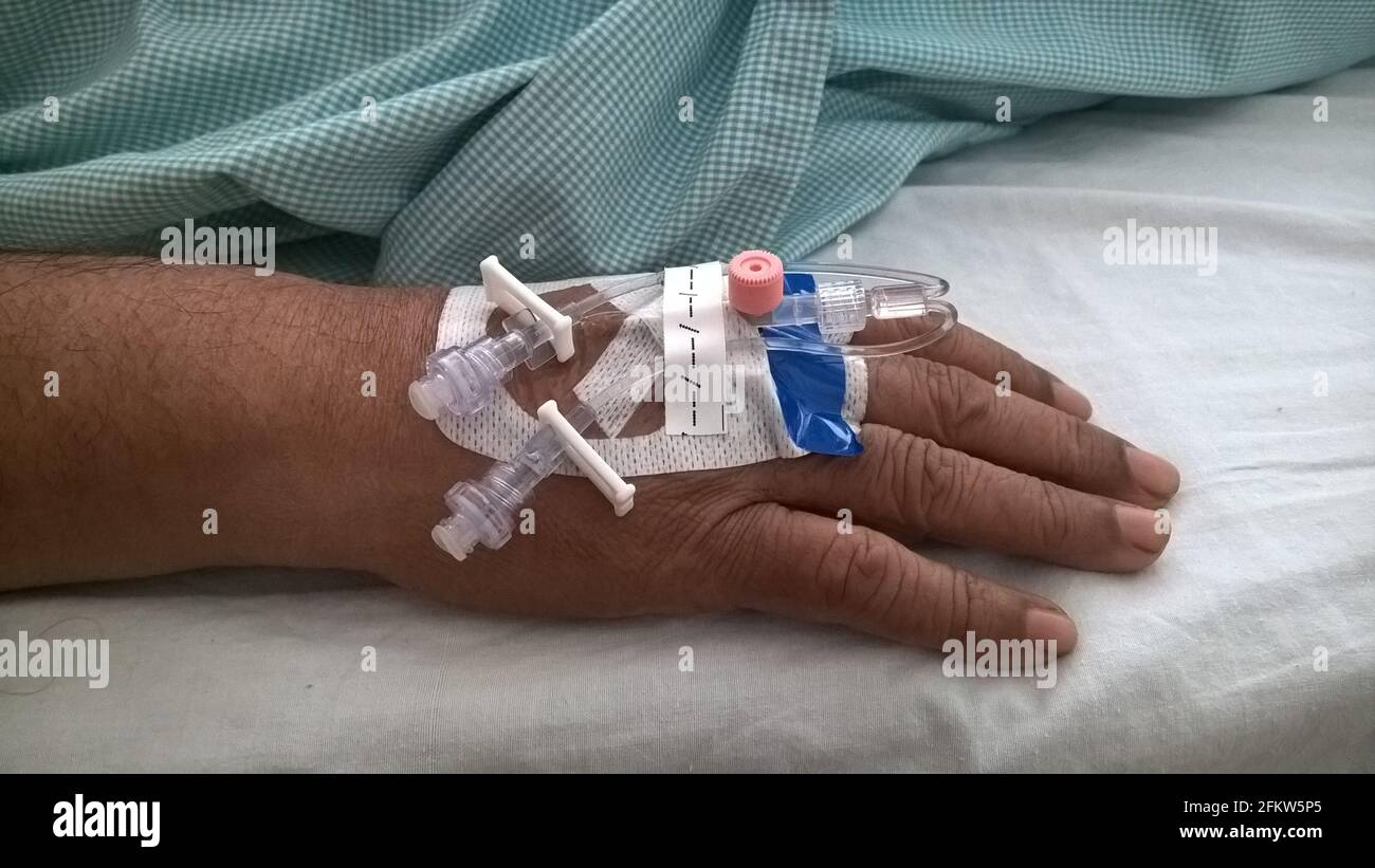 Hand mit peripheren intravenösen Kanülen oder Kathetern Stockfoto