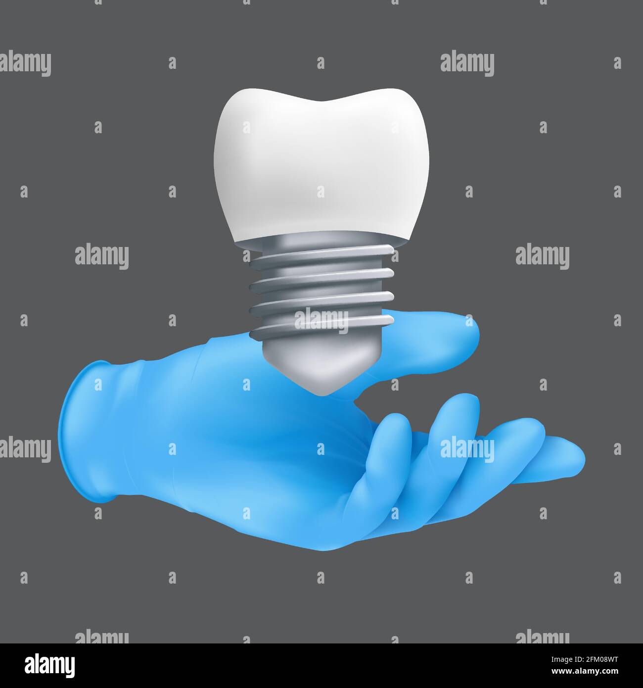Zahnarzt Hand trägt blauen Schutz OP-Handschuh mit einem keramischen Modell des Zahnes. 3d realistische Vektordarstellung von Zahnimplantaten Konzept Stock Vektor