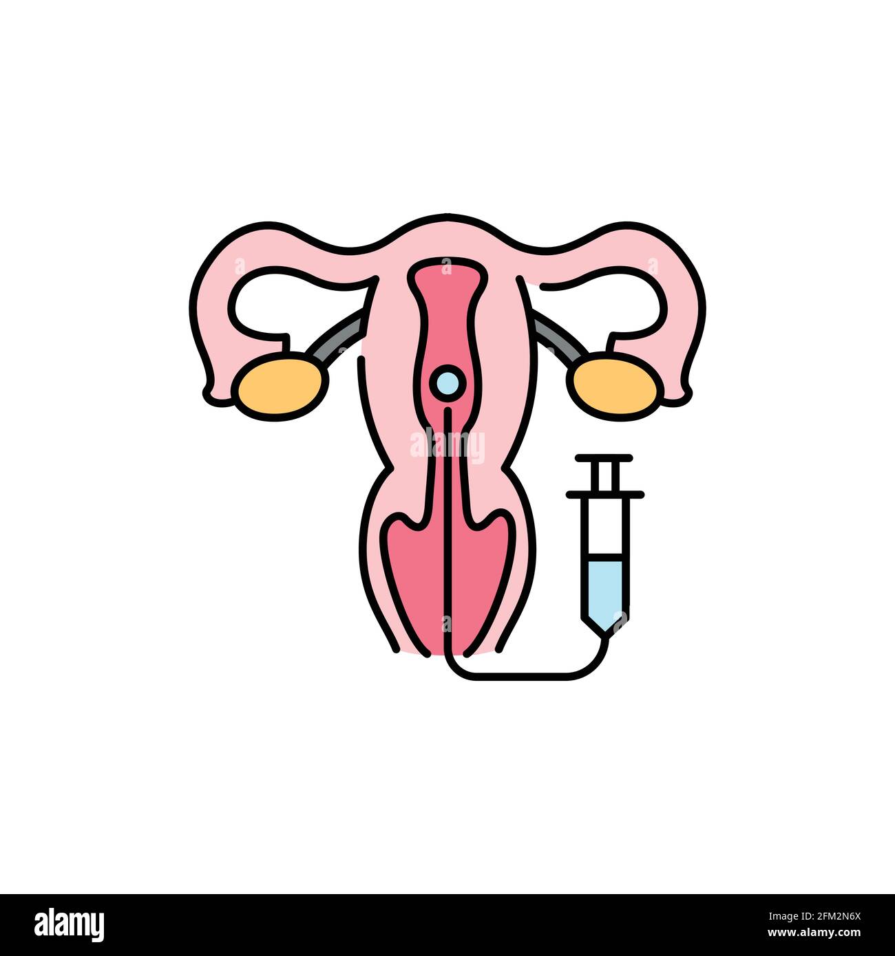 Symbol für Embryo-Transfer-Farblinie. Schwangerschaft. Piktogramm für Webseite, mobile App, Promo. UI UX GUI Design-Element. Bearbeitbare Kontur. Stock Vektor