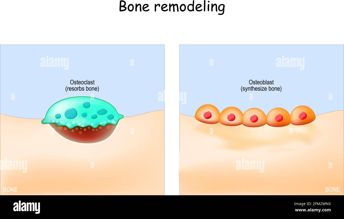 Knochenaufbau. Nahaufnahme eines Osteoklasten resorbiert Knochen, und Osteoblasten synthetisierten Knochengewebe. Vektorgrafik Stock Vektor