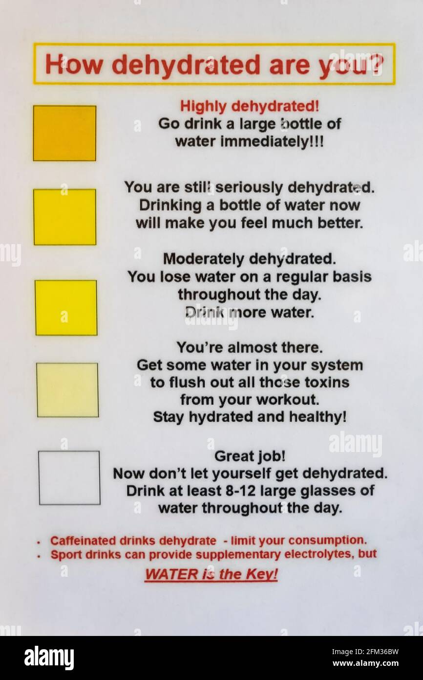 Warnschild für Dehydratation im Saguaro National Park, Tucson Mountain District, Arizona, USA Stockfoto