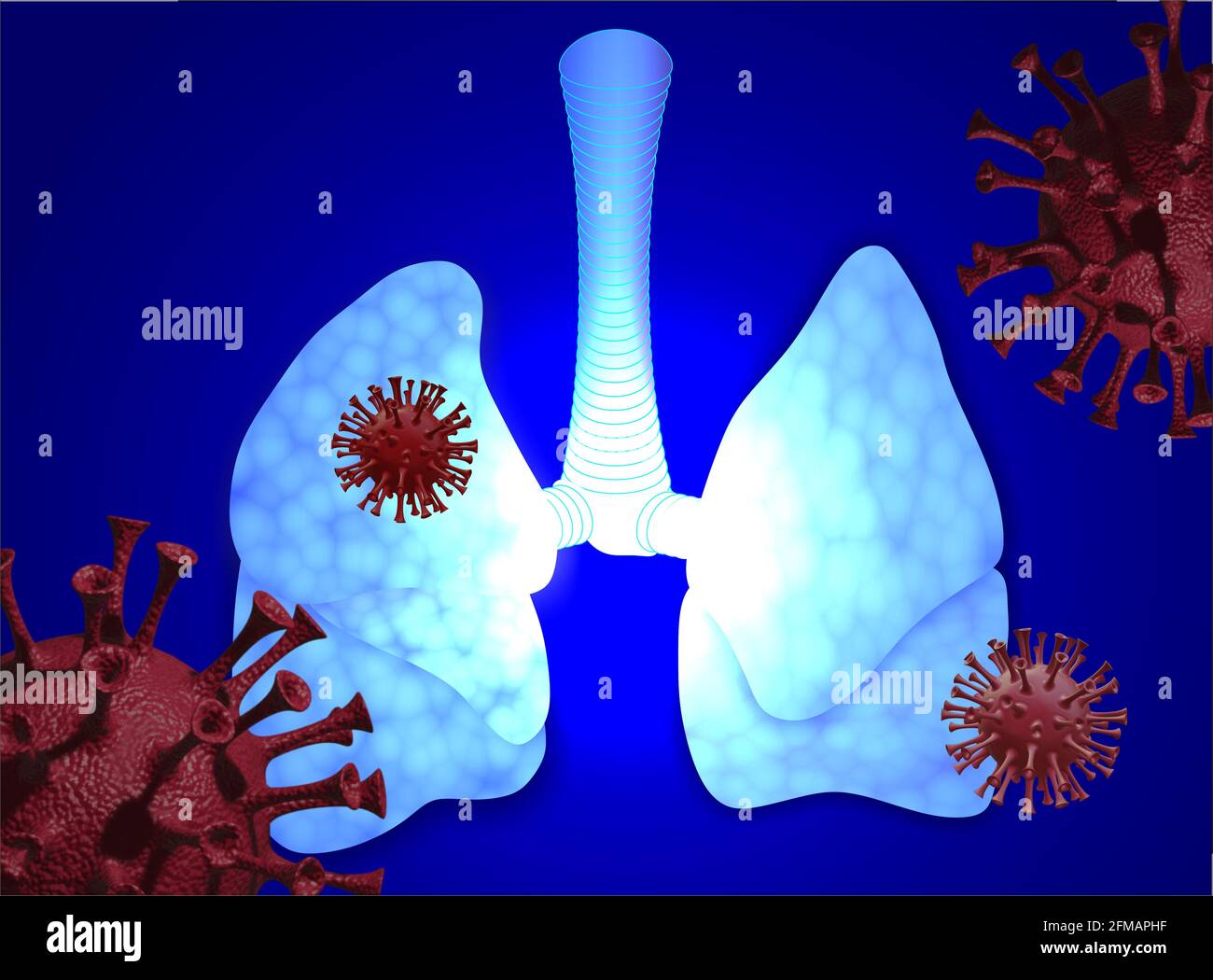 Menschliche Lunge, Covid-19, Coronavirus Stockfoto
