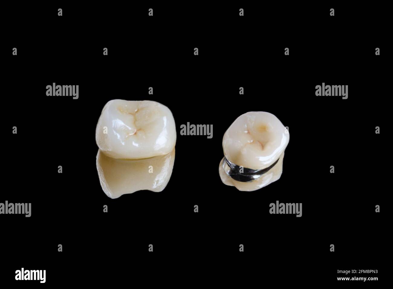 Keramik und Metall-Keramik Kronen isoliert auf schwarzem Hintergrund Stockfoto