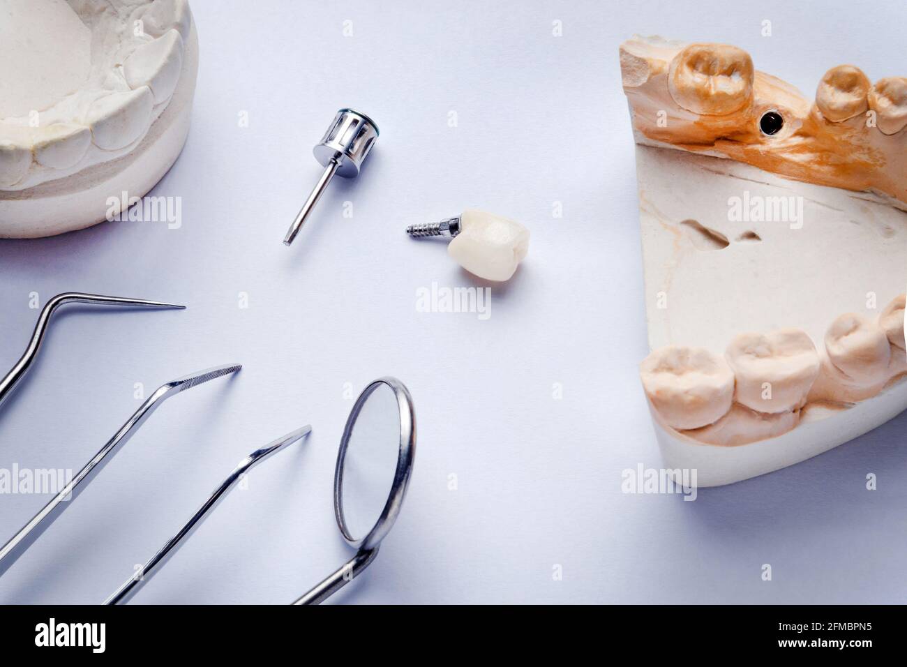 Zahnimplantatkrone auf weißem Hintergrund mit Gipsmodellen und zahnärztlichen Instrumenten, Sonde, Spiegel und Pinzette Stockfoto
