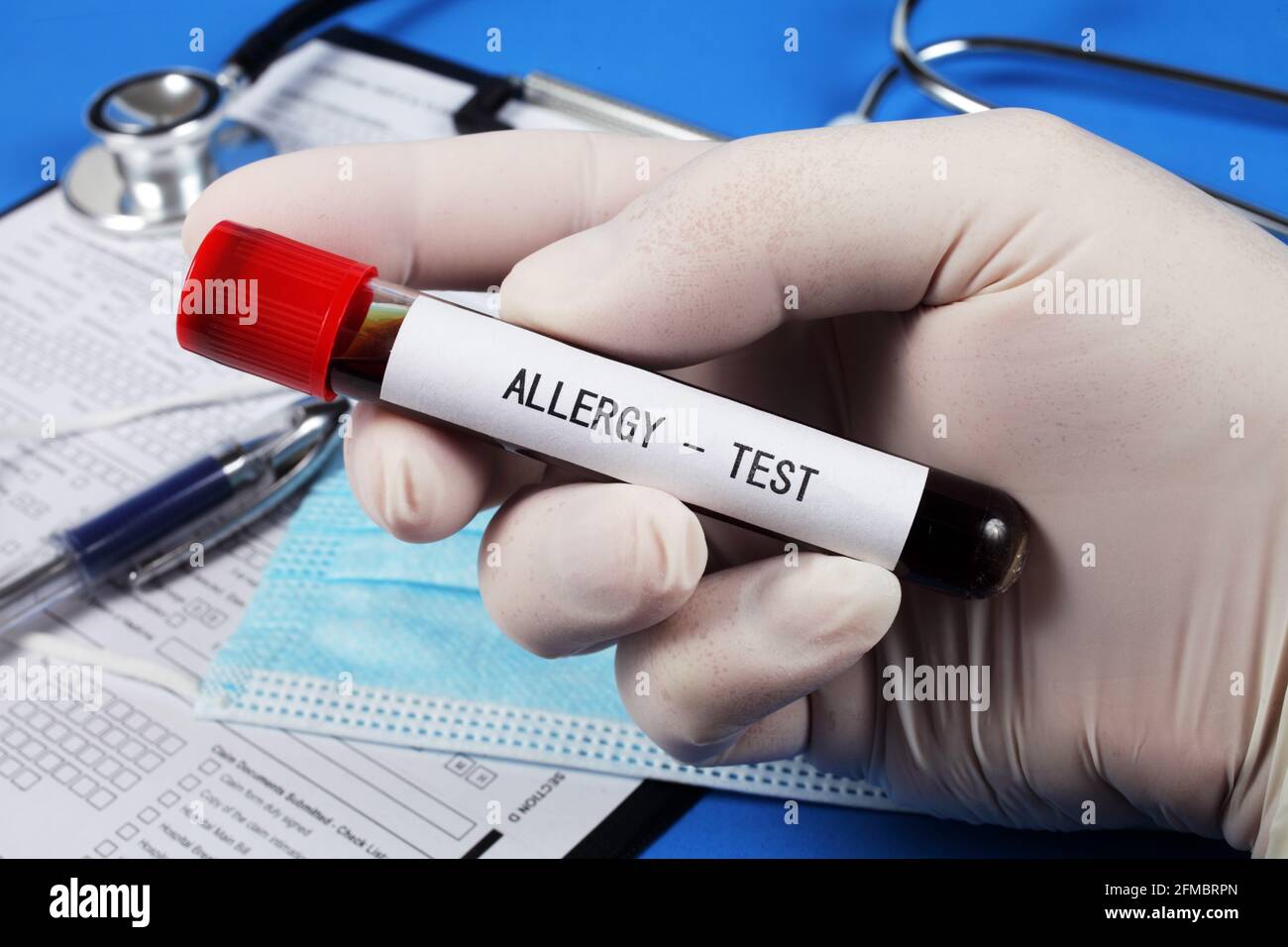 Allergietest, Vakuumröhrchen mit Blut in der Hand des Arztes, selektiver Fokus, Nahaufnahme. Stockfoto