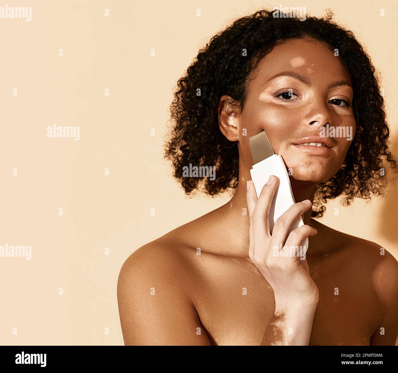 Ultraschallpeeling für das Gesicht einer Frau mit Vitiligo und problematischer Haut mit Ultraschallschrubber. Reinigende Gesichtshaut Stockfoto