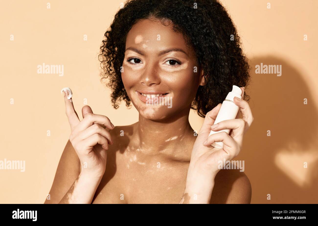 Gesichtscreme feuchtigkeitsspendende Haut. Positive afroamerikanische Frau mit Vitiligo trägt feuchtigkeitsspendende Creme auf ihrem Gesicht, auf einem beigen Hintergrund Stockfoto