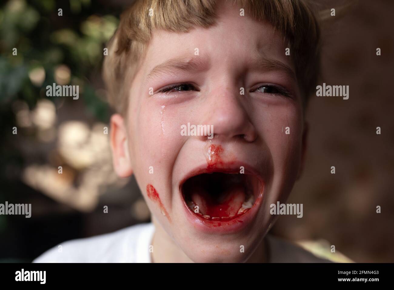 Plötzlicher Tod Mit Blut Aus Dem Mund www.alamy.de