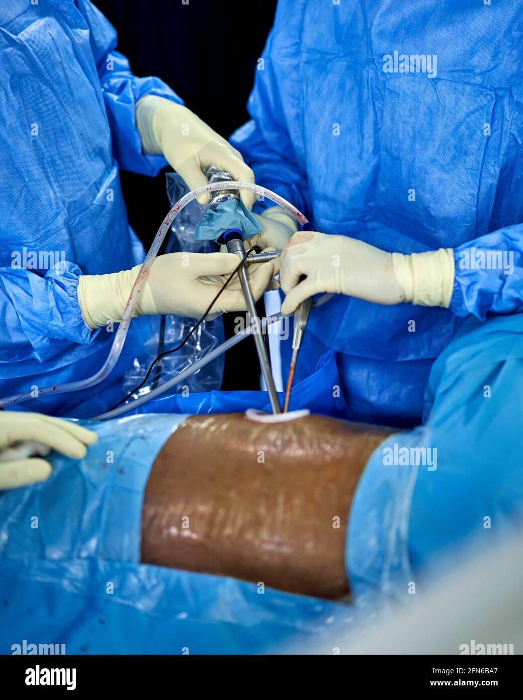 Multiethnischen Chirurgen in der medizinischen Masken der Patient im Operationssaal Stockfoto