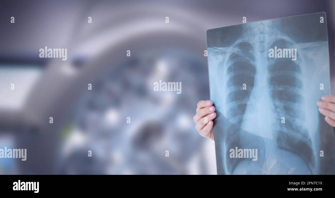 Mittlerer Abschnitt des Arztes, der Röntgenbericht gegen Operationslicht untersucht Im Hintergrund Stockfoto