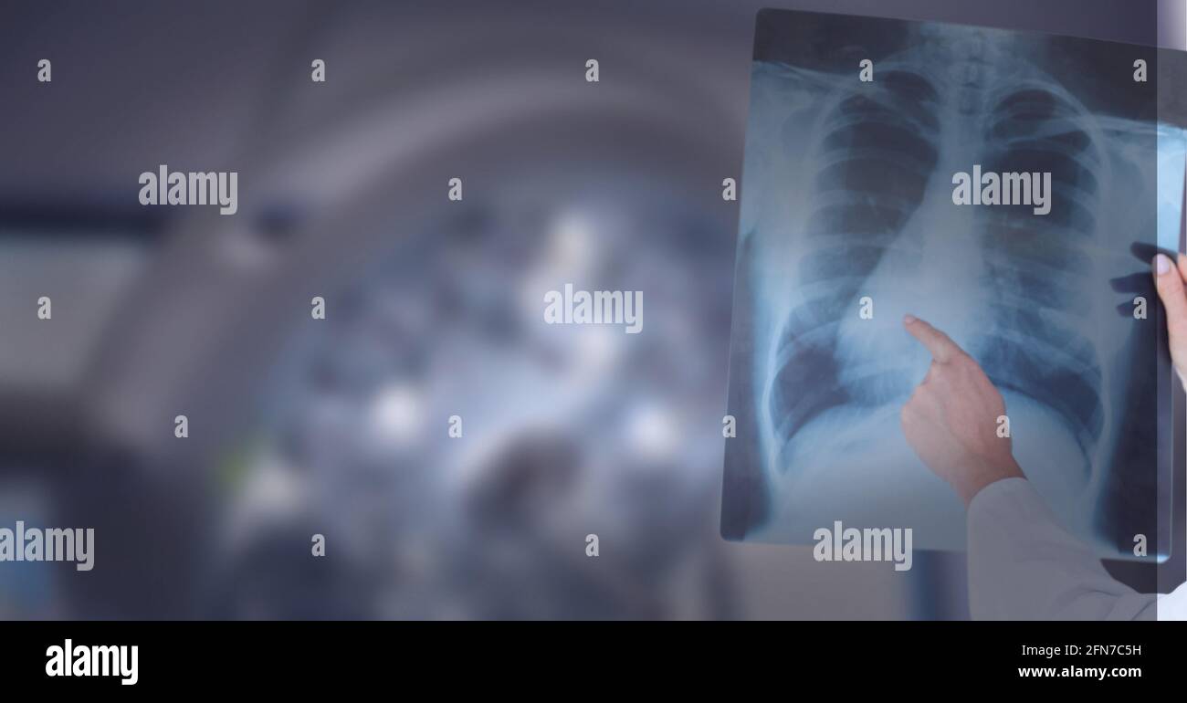 Mittlerer Abschnitt des Arztes, der Röntgenbericht gegen Operationslicht untersucht Im Hintergrund Stockfoto