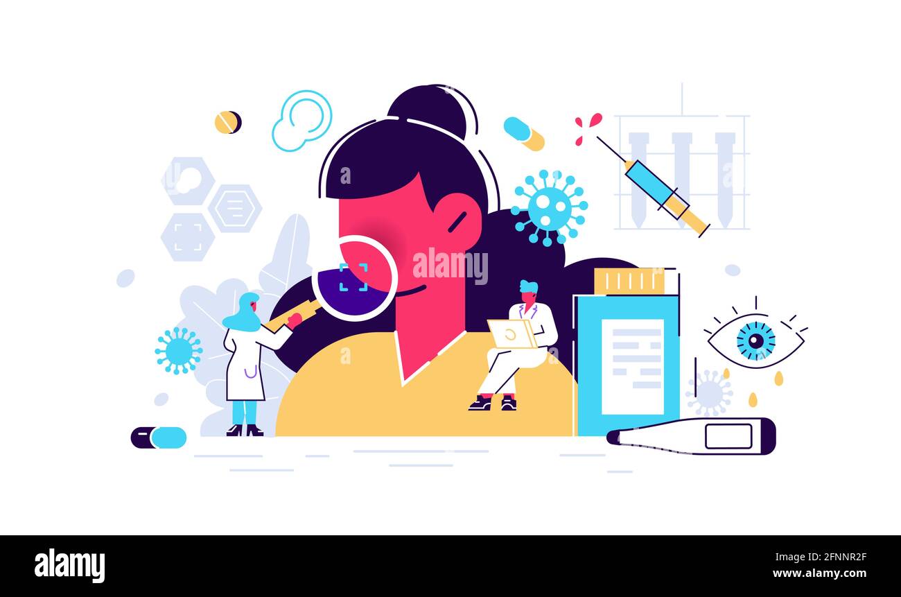 Allergische Reaktionen des Menschen und Allergie-Pharmazie-Therapie Stock Vektor