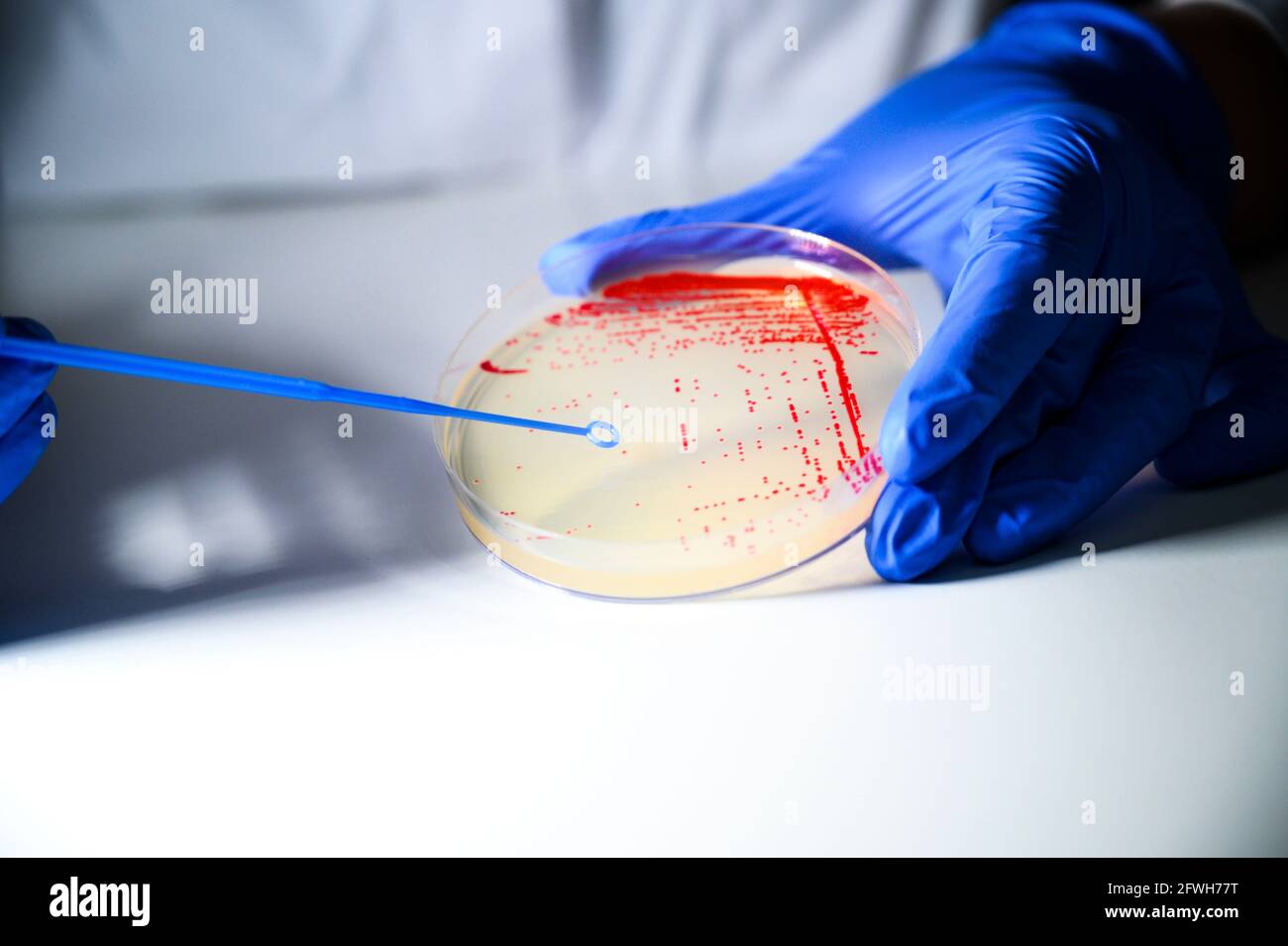 Reasercher nimmt Kolonie einer roten Bakterienkultur ab Agarplatte in einem molekularbiologischen Labor zur Isolierung Von arzneimittelresistenten Mutanten Stockfoto