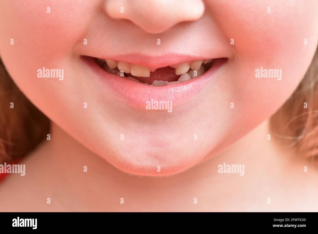 Kind lächelt mit dem ersten abgefallenen Babyzahn Stockfoto