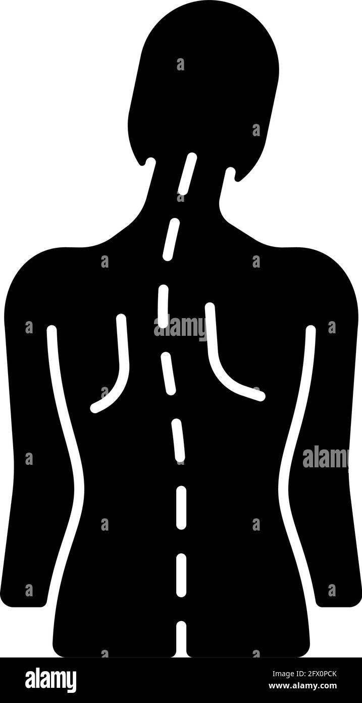 Schwarzes Glyphensymbol für spinale Anomalien Stock Vektor