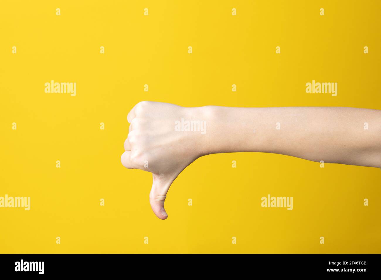 Hand in Faust mit Daumen nach unten auf gelbem Hintergrund. Symbol, Zeichen, Symbol für Verlust oder Störung. Gebärdensprache oder und dumm. Stockfoto