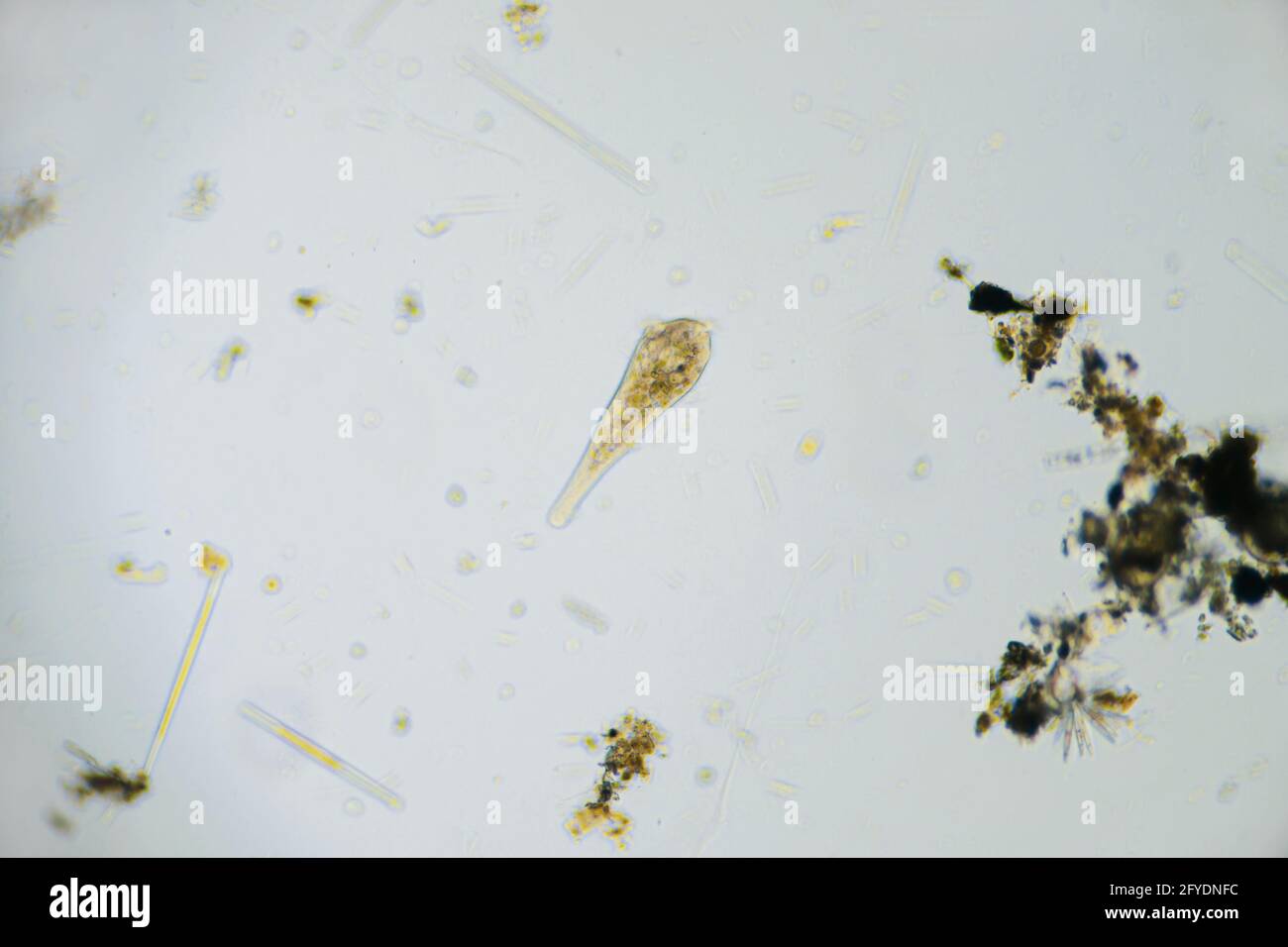 Ciliates Stentor im Süßwasserteich unter dem Lichtmikroskop gefunden Stockfoto