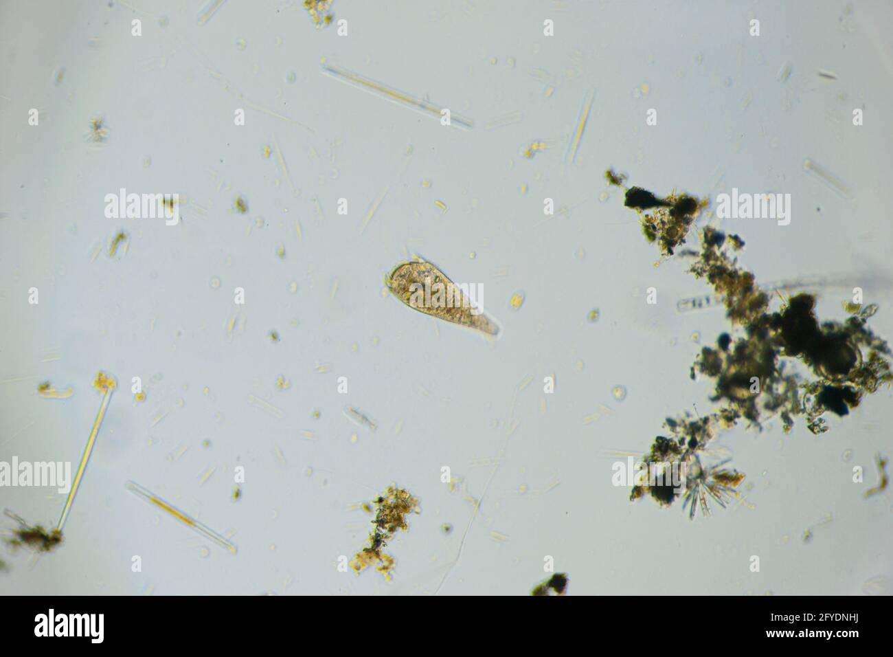 Ciliates Stentor im Süßwasserteich unter dem Lichtmikroskop gefunden Stockfoto