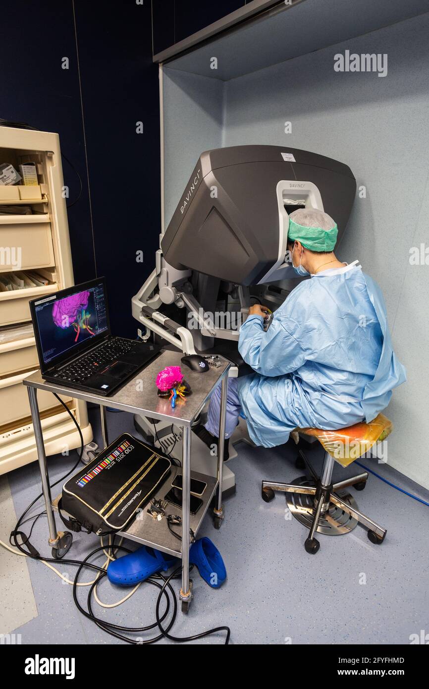 Bildgeführte, robotische konservative Nierenchirurgie unterstützt durch 3D-Modellierung, führt diese 3D-Modellierung der Niere mit ihrem Tumor in violett die e an Stockfoto
