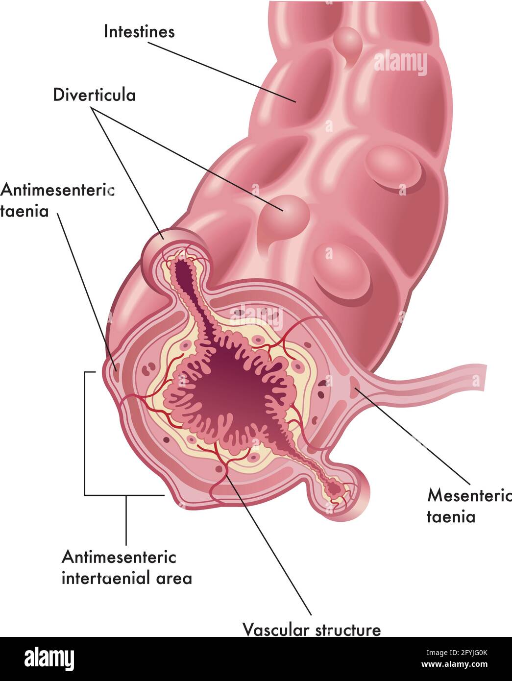 Medizinische Illustration der Anatomie der Divertikel, mit Anmerkungen. Stock Vektor