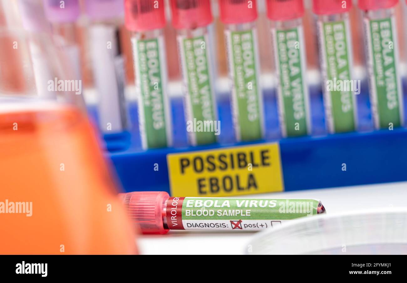 Blutprobe von Ebola-Patienten, positives Ergebnis, konzeptuelles Bild Stockfoto