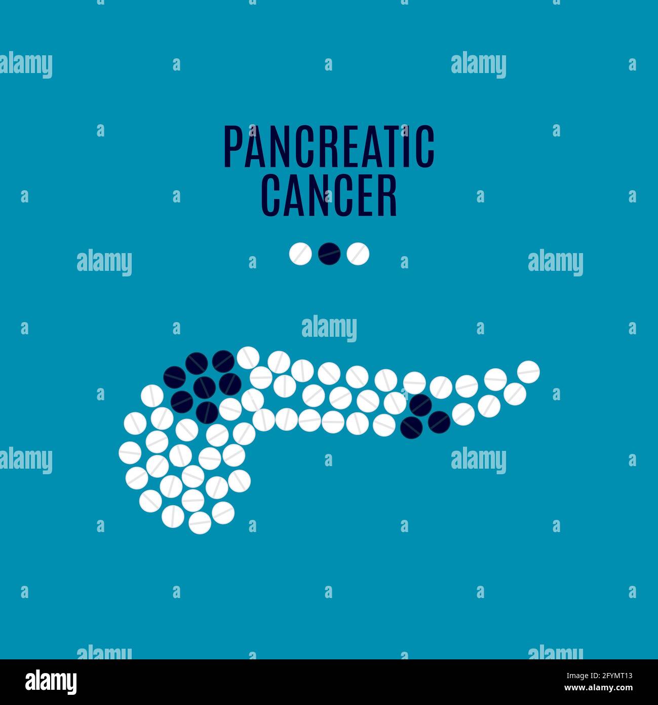 Bauchspeicheldrüsenkrebs, konzeptionelle Illustration Stockfoto