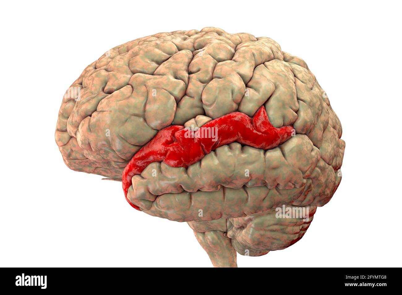 Gehirn, das den oberen Temporalgyrus hervorhebt, Illustration Stockfoto