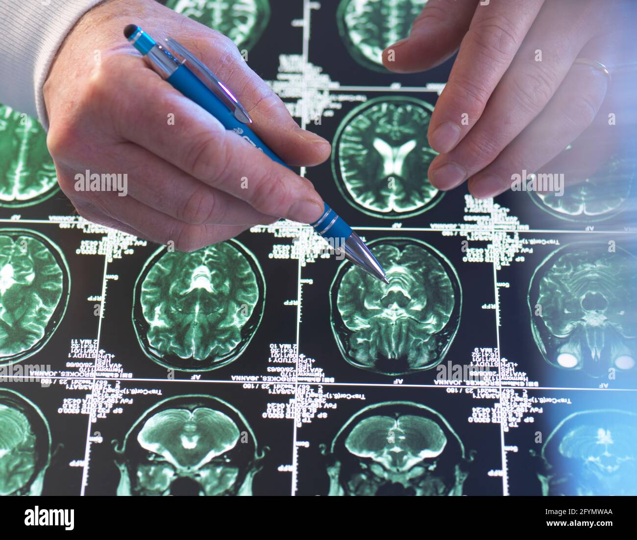 Neurologische Diagnose Stockfoto