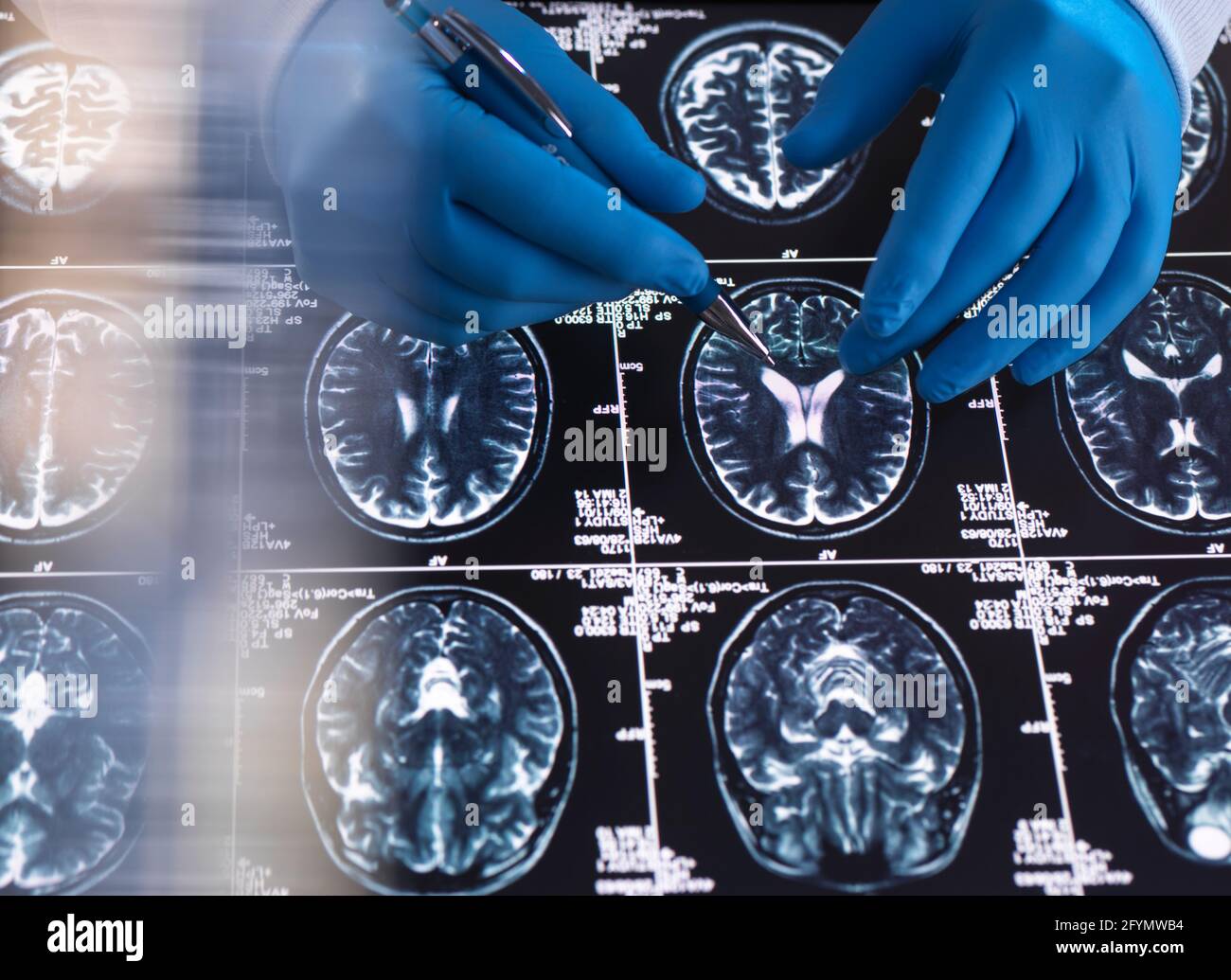 Neurologische Diagnose Stockfoto